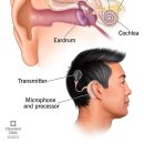 와우보청기 이미지
