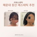 리에스테틱 해운대 장산점