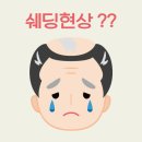 [탈모, 그것이 궁금하다] ＜40＞쉐딩 현상과 발모효과 이미지