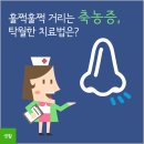 훌쩍훌쩍 축농증, 탁월한 치료법은?| 이미지