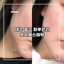 행복한피부사랑 | 대구 중구 피부관리 브이에스테틱에서 림프 순환부터 탄력까지 끌어올린 솔직 후기