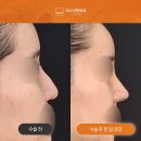 태성형외과의원 | 대전성형외과 희소, 상담부터 수술까지 디테일의 차이