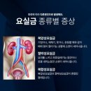 ◇ 요실금의 종류, 증상 및 치료 방법 ◇ 이미지