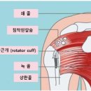 어깨석회성건염 어깨근육통증 체외충격파치료기로 완치될까 이미지