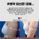 베스트피부과의원 네이버블로그
