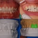 세라치과기공소 이미지