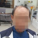 전주동안가발 네이버블로그