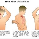 근막 통증 증후군은 왜 생기나요~ 이미지