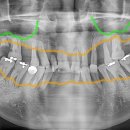 미켈란치과의원 이미지