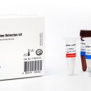 에스디바이오센서(주) 이미지