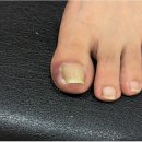 남악한방병원 | 목포 남악 내성발톱 세심한 케어 뷰티업라이프 가온네일&amp;페디