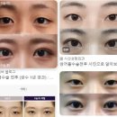 부산 동래구 성형외과 잘하는 곳, 유명한 곳, 리뷰 인기순위 TOP 7