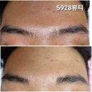5928뷰티 이미지