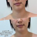 오월(5월) | 빛나는 광주신부관리, 인생샷 예약 보장하는 오월에스테틱 솔직 후기!