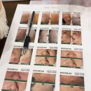 (주)홈가원 | [부천] 송내 홈케어까지 신경 써주는 부천 피부관리 더채움에스테틱에서 여드름관리