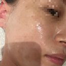 도연에스테틱 | 부산웨딩 동래윤곽관리 유명한 도연에스테틱 솔직 후기! (통증없이 시원함)