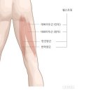 도시기억상실증 이미지