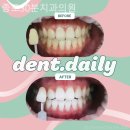 데일리치과의원 | 종로3가치과 종로30분치과의원 편안하게 다가오는 시간!