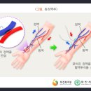 만성신부전 동정맥루조성술치료비 (급여, 연간1회한)보장 특별약관 (만성신부전의 정의 및 진단확정) 이미지