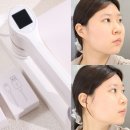 바른가정식 | 피부 홈케어 뷰티 디바이스 추천, 슈링크홈 리프투글로우 후기 얼굴 탄력 리프팅기기 안티에이징