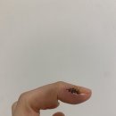 예손약국 | 손가락통증 사구체종 사구체종양 입원 및 수술후기_부천 예손병원.v2