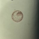 협동수지(구 성공산업) | 5일 배양 포배기 1개 신선이식