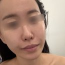 청량리30 | 청량리 피부관리 윤곽관리 더작 청량리동대문점 후기