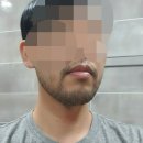 매산프라자 | [피부과] 수원역 피부과 수염 레이저제모 후기 (내돈내산)