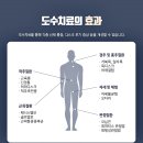 정다운신경외과의원 네이버블로그