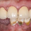 이안치과기공소 이미지