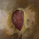 보건약방 | 전국 요양병원의 돈벌이 수단인 욕창들에 가루 항생제인 마이싱과 숭늉 및 원적외선 찜질기로 새살-간병...