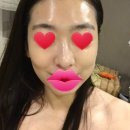 예님피부업!