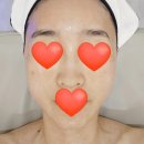 두피랑피부랑 | 원주 단계동 피부관리 추천 헤븐리데 셀포커스관리와 두피테라피 후기