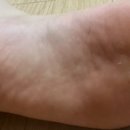 메디레스큐 이미지