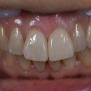 세온 치과기공소 이미지