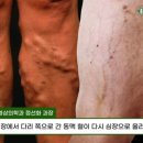 인천기독병원