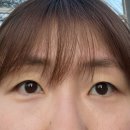 르포엠래쉬