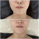 다온에스테틱 | 동래피부관리 "다온에스테틱" 리프팅 윤곽관리 방문 후기 🧡