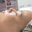 삼문중앙로6길 | 밀양에스테틱 3D물광필 후기 밀양 늘쁨에스테틱 3D물광필 런칭이벤트중