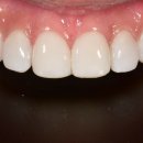 세라치과기공소 이미지