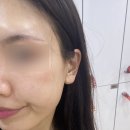 벨르하 | 삶은 달걀 피부 원해? 인천 구월동피부관리 벨르하 에그 스킨플래닝 찐추천 후기!