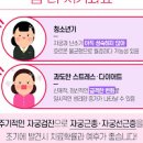 자궁 근종(물혹) 및 원인과 검사 예방 : 크기 통증 폐경기 임신 이미지