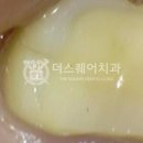 더스퀘어치과기공소 이미지