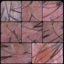 경기도 수원시 영통구 봉영로 | 수원탈모관리 두피밥 영통유기농두피 두피스케일링 찐 후기