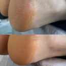 안나메디칼 네이버블로그