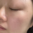 핑크스킨 | 레티놀 추천｜스킨이치 레티놀 핑크세럼 주름개선 입문템 사용후기