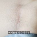 어제모했어슈가왁싱