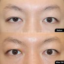 뷰라밸성형외과의원 이미지