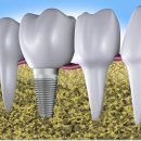 새서울플란트치과의원 이미지