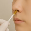코비한의원 | 나잘스프레이 사용법 및 처방, 알레르기성 비염 솔직후기